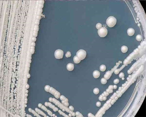 包生男孩包成功,卵巢早衰做试管机会大吗-卵巢早衰试管*率高吗