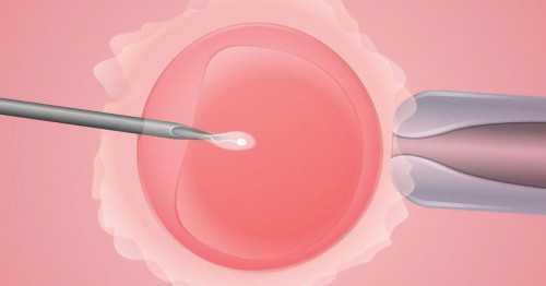 代孕费用行情,子宫单层内膜厚度多少正常！子宫内膜厚度多少正常4mm正常吗！