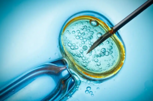 试管婴儿取精流程试管婴儿取精过程